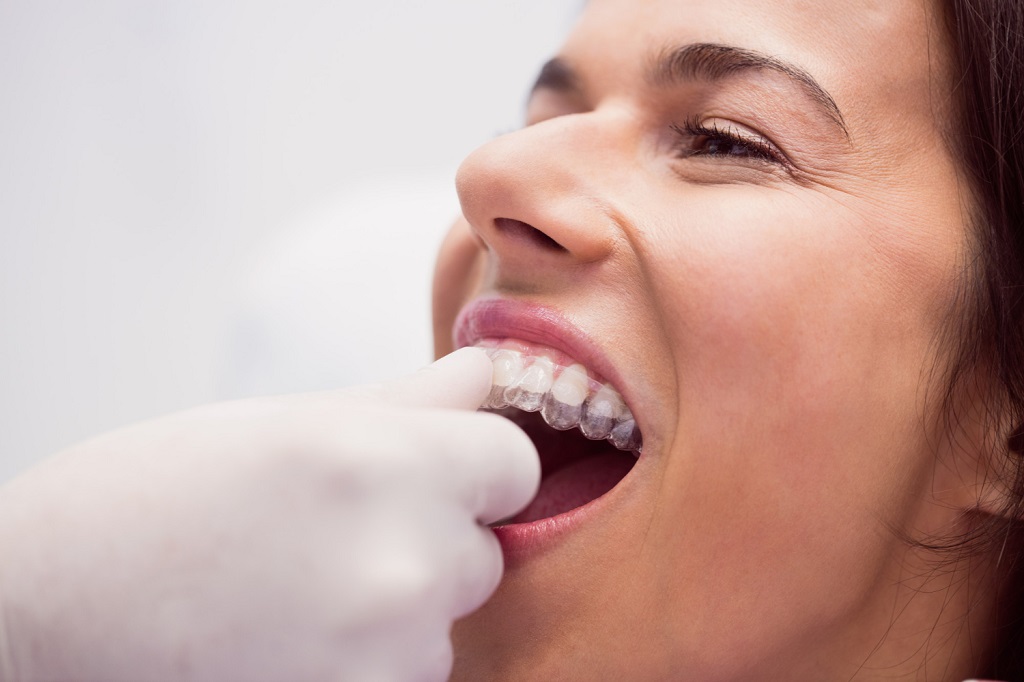aumento en tratamientos de ortodoncia